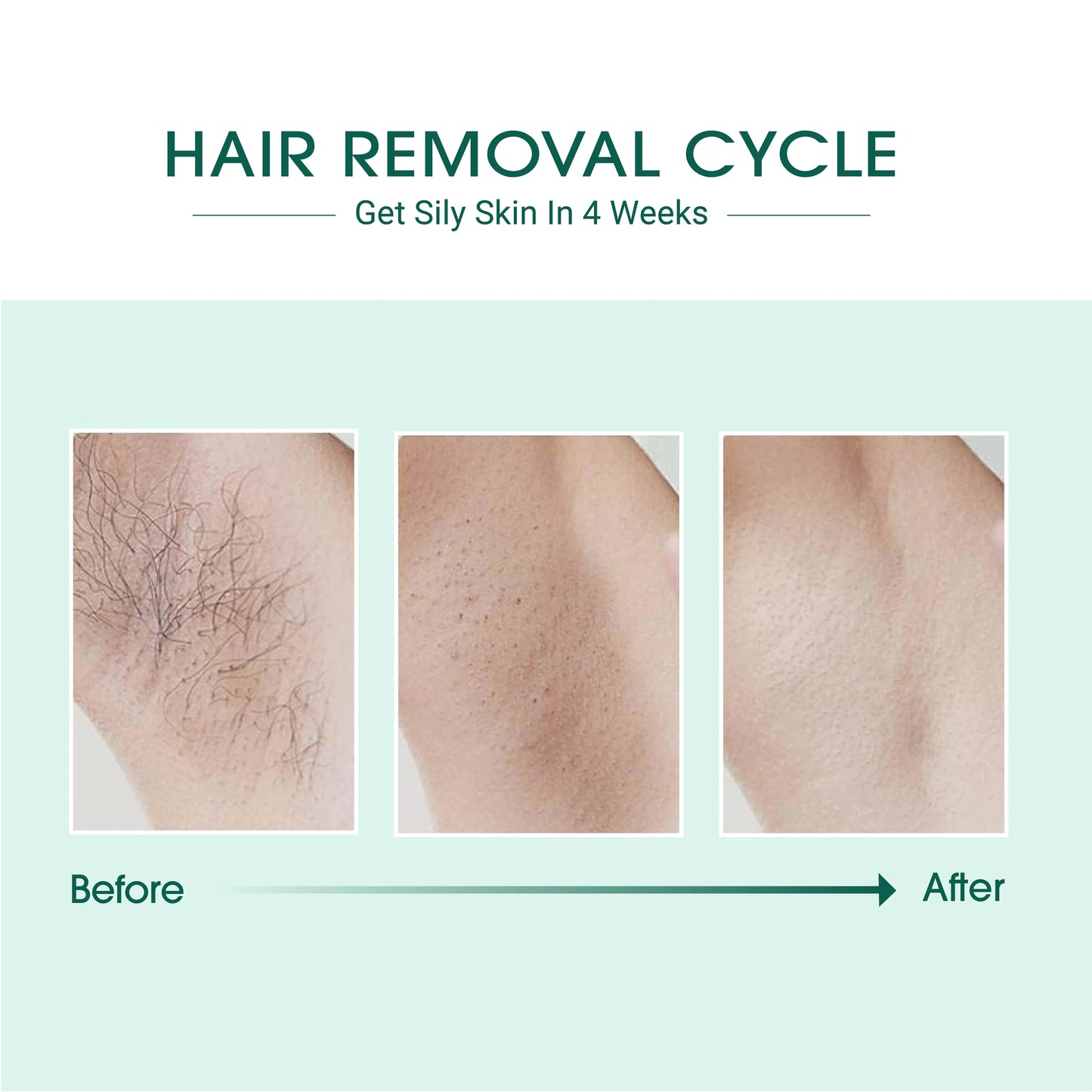 SmoothPulse Hair Removal System